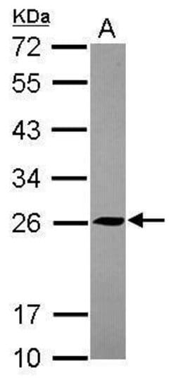 Invitrogen TMED5 Polyclonal Antibody 100 &mu;L | Buy Online | Invitrogen&trade; | Fisher Scientific