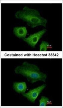 Invitrogen OLFML3 Polyclonal Antibody 100 &mu;L | Buy Online | Invitrogen&trade; | Fisher Scientific