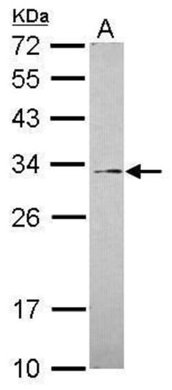 Invitrogen GALNT12 Polyclonal Antibody 100 &mu;L; Unconjugated:Antibodies,