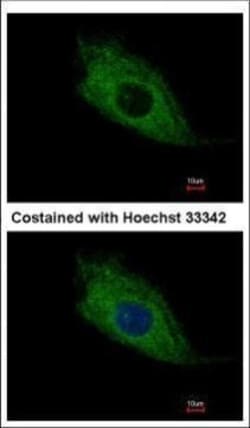 Invitrogen TMEM66 Polyclonal Antibody 100 &mu;L | Buy Online | Invitrogen&trade; | Fisher Scientific