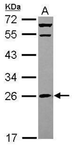 Invitrogen MRPS26 Polyclonal Antibody 100 μL; Unconjugated:Antibodies,