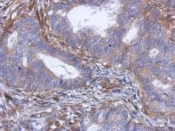 Invitrogen PABPC5 Polyclonal Antibody 100 &mu;L; Unconjugated:Antibodies,