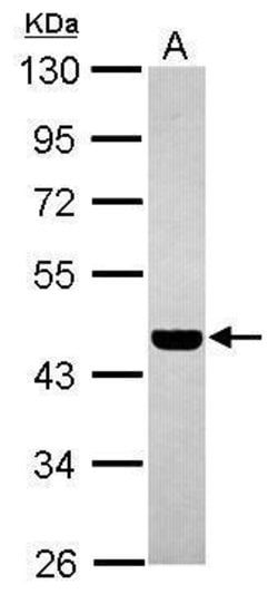 Invitrogen PABPC5 Polyclonal Antibody 100 &mu;L; Unconjugated:Antibodies,