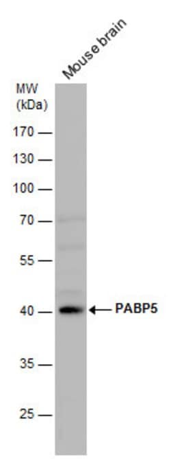 Invitrogen PABPC5 Polyclonal Antibody 100 &mu;L; Unconjugated:Antibodies,
