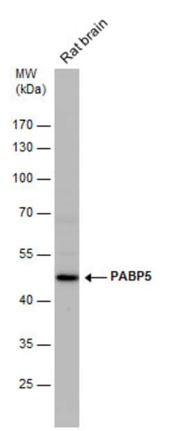 Invitrogen PABPC5 Polyclonal Antibody 100 &mu;L; Unconjugated:Antibodies,