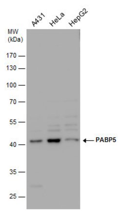 Invitrogen PABPC5 Polyclonal Antibody 100 &mu;L; Unconjugated:Antibodies,