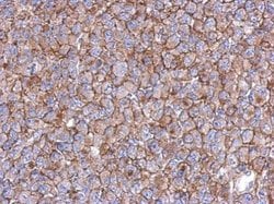 Invitrogen KIAA0090 Polyclonal Antibody 100 μL; Unconjugated:Antibodies,