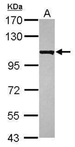 Invitrogen KIAA0090 Polyclonal Antibody 100 μL; Unconjugated:Antibodies,