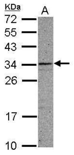 Invitrogen CCDC107 Polyclonal Antibody 100 &mu;L; Unconjugated:Antibodies,