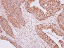 Invitrogen MOSC2 Polyclonal Antibody 100 &mu;L; Unconjugated:Antibodies,