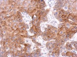 Invitrogen FCHO1 Polyclonal Antibody 100 &mu;L | Buy Online | Invitrogen&trade; | Fisher Scientific