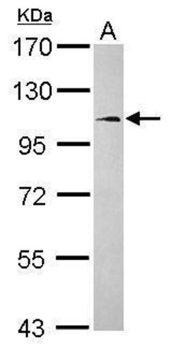 Invitrogen FCHO1 Polyclonal Antibody 100 &mu;L | Buy Online | Invitrogen&trade; | Fisher Scientific