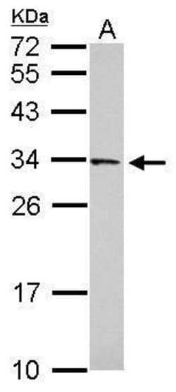 Invitrogen FAM78B Polyclonal Antibody 100 &mu;L; Unconjugated:Antibodies,
