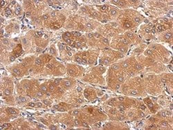 Invitrogen SLC25A36 Polyclonal Antibody 100 &mu;L | Buy Online | Invitrogen&trade; | Fisher Scientific