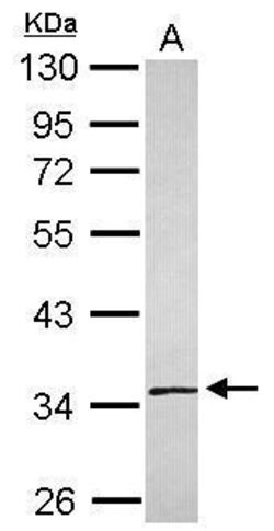 Invitrogen SLC25A36 Polyclonal Antibody 100 &mu;L | Buy Online | Invitrogen&trade; | Fisher Scientific