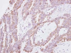 Invitrogen EAP30 Polyclonal Antibody 100 μL; Unconjugated:Antibodies,