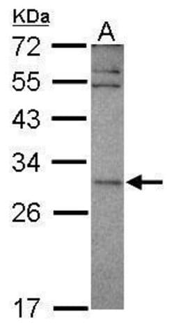 Invitrogen EAP30 Polyclonal Antibody 100 μL; Unconjugated:Antibodies,