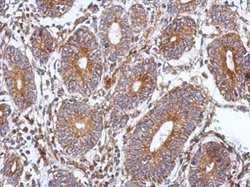 Invitrogen SPAG8 Polyclonal Antibody 100 μL; Unconjugated:Antibodies,