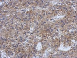 Invitrogen PPFIBP1 Polyclonal Antibody 100 μL; Unconjugated:Antibodies,