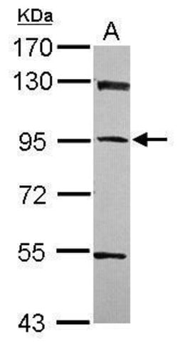 Invitrogen PPFIBP1 Polyclonal Antibody 100 μL; Unconjugated:Antibodies,