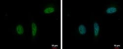 Invitrogen RPRD1B Polyclonal Antibody 100 &mu;L; Unconjugated:Antibodies,