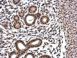 Invitrogen RPRD1B Polyclonal Antibody 100 &mu;L; Unconjugated:Antibodies,