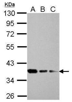 Invitrogen RPRD1B Polyclonal Antibody 100 &mu;L; Unconjugated:Antibodies,