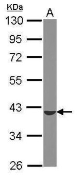Invitrogen ST6GALNAC4 Polyclonal Antibody 100 &mu;L; Unconjugated:Antibodies,