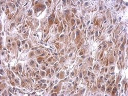 Invitrogen SLFNL1 Polyclonal Antibody 100 &mu;L; Unconjugated:Antibodies,