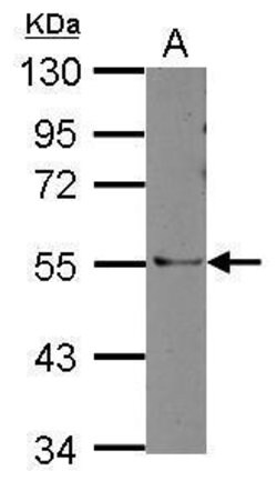 Invitrogen ARHGAP36 Polyclonal Antibody 100 &mu;L; Unconjugated:Antibodies,
