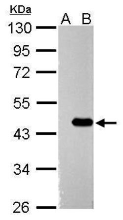 Invitrogen ZBTB24 Polyclonal Antibody 100 &mu;L; Unconjugated:Antibodies,