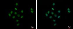 SYAP1 Polyclonal Antibody, Invitrogen 100 &mu;L; Unconjugated:Antibodies,