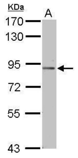 Invitrogen PODN Polyclonal Antibody 100 &mu;L; Unconjugated:Antibodies,