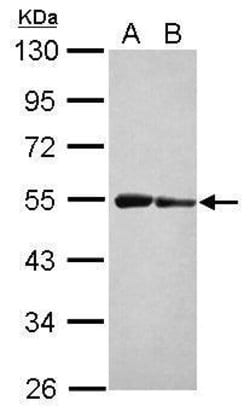 Invitrogen ST3GAL3 Polyclonal Antibody 100 &mu;L; Unconjugated:Antibodies,