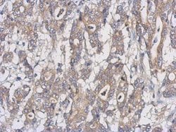 Invitrogen UXS1 Polyclonal Antibody 100 &mu;L | Buy Online | Invitrogen&trade; | Fisher Scientific