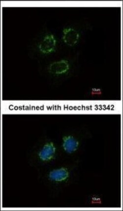 Invitrogen TTLL10 Polyclonal Antibody 100 μL; Unconjugated:Antibodies,