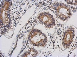 Invitrogen TTLL10 Polyclonal Antibody 100 μL; Unconjugated:Antibodies,