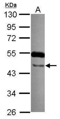Invitrogen TTLL10 Polyclonal Antibody 100 μL; Unconjugated:Antibodies,