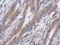 Invitrogen FBXW5 Polyclonal Antibody 100 &mu;L; Unconjugated:Antibodies,