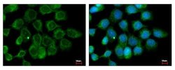 Invitrogen ALS2CR12 Polyclonal Antibody 100 &mu;L; Unconjugated:Antibodies,
