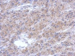 Invitrogen ALS2CR12 Polyclonal Antibody 100 &mu;L; Unconjugated:Antibodies,
