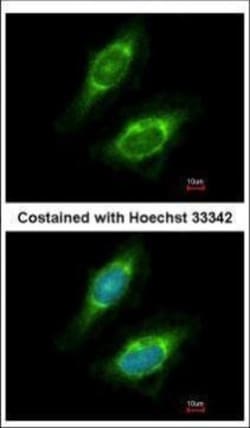 Invitrogen CKAP4 Polyclonal Antibody 100 μL; Unconjugated:Antibodies,