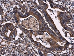 Invitrogen CKAP4 Polyclonal Antibody 100 μL; Unconjugated:Antibodies,