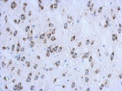 Invitrogen CKAP4 Polyclonal Antibody 100 μL; Unconjugated:Antibodies,