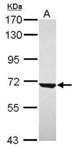 Invitrogen CKAP4 Polyclonal Antibody 100 μL; Unconjugated:Antibodies,