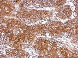Invitrogen THOC5 Polyclonal Antibody 100 &mu;L; Unconjugated:Antibodies,