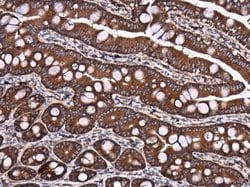 Invitrogen DYNC1LI1 Polyclonal Antibody 100 &mu;L; Unconjugated:Antibodies,