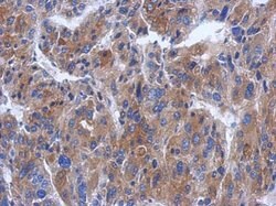 Invitrogen CWF19L1 Polyclonal Antibody 100 &mu;L; Unconjugated:Antibodies,