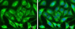 Invitrogen ZC3HAV1 Polyclonal Antibody 100 &mu;L; Unconjugated:Antibodies,