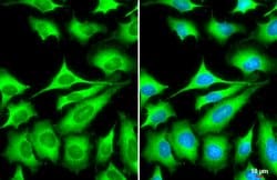 Invitrogen ZC3HAV1 Polyclonal Antibody 100 &mu;L; Unconjugated:Antibodies,